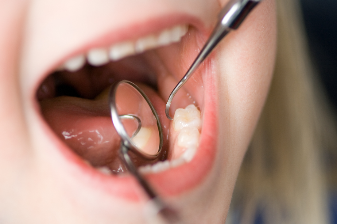 Odontopediatría - Odontosalud Barracas
