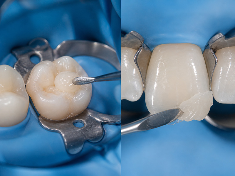 Materiales de primera marca Odontosalud Barracas